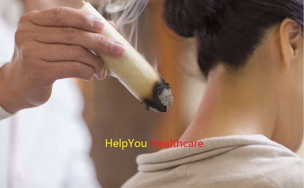 Pure Moxa Rolls for Moxibustion/Chinese Traditional moxibustion