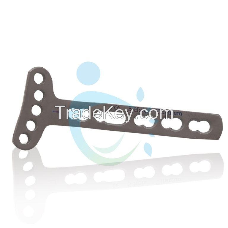 Orthopedic Trauma Lock Plates Exporters 2.7mm Distal Radius Locking Plate, Titanium