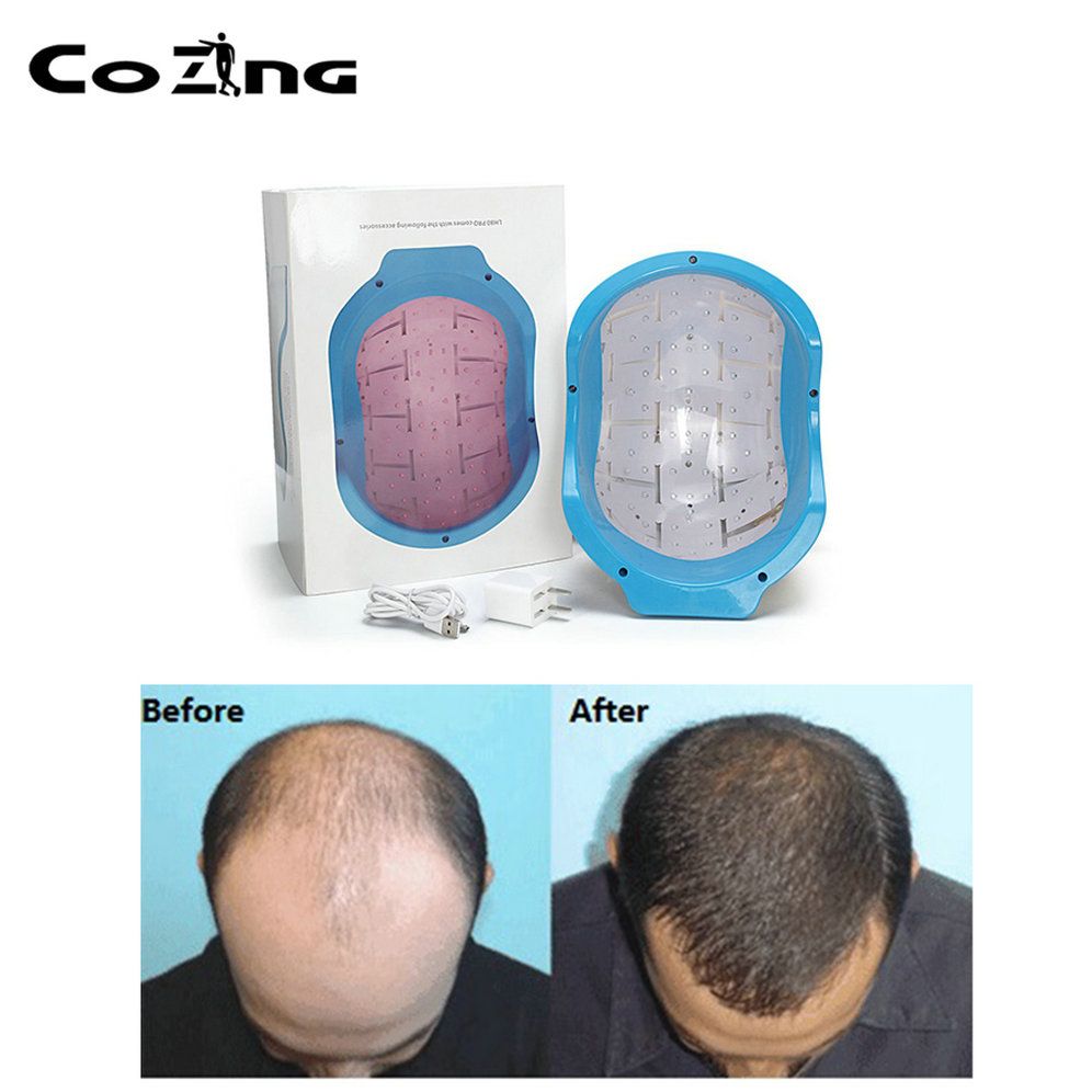 Portable Bald laser Head Hair Growth cold laser treatment helmet for h