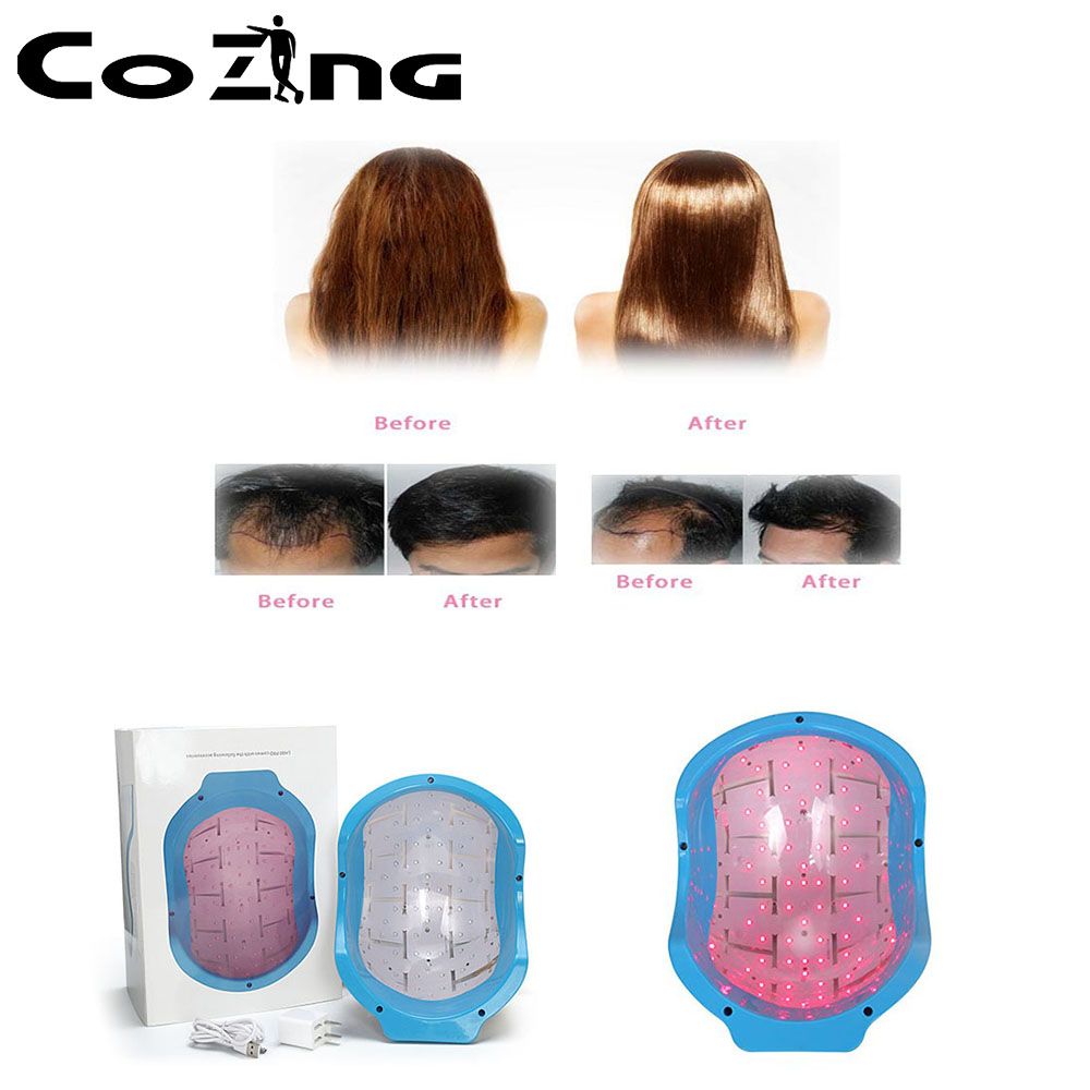 Portable Bald laser Head Hair Growth cold laser treatment helmet for h