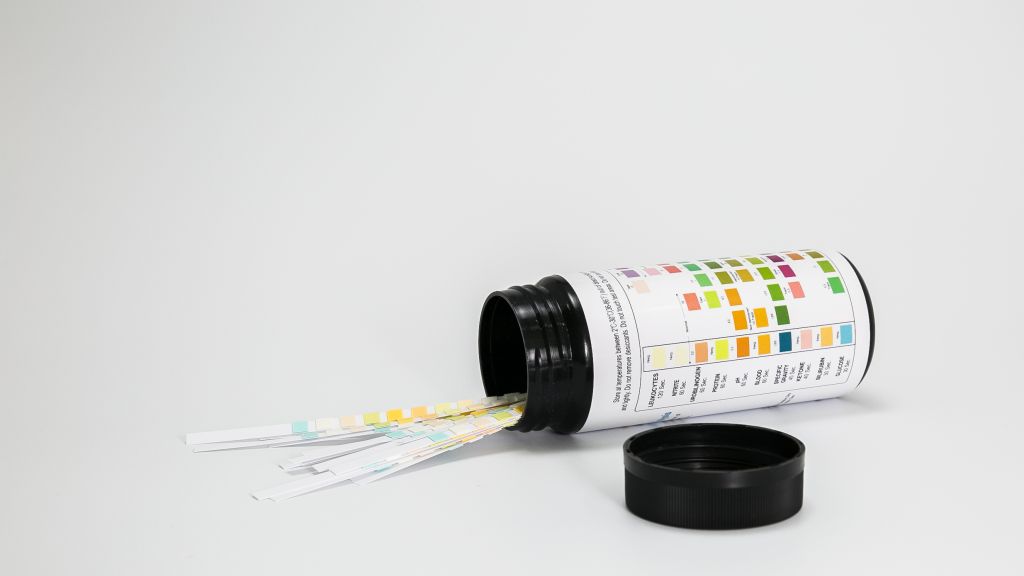 urine reagent strips