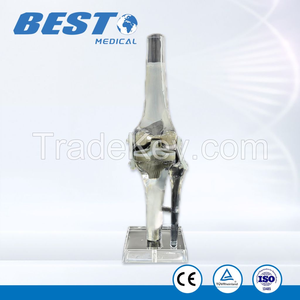 Transparent Clear Resin Femoral &amp;amp;amp; Tibial Bones Model with Locking Plates and Nails