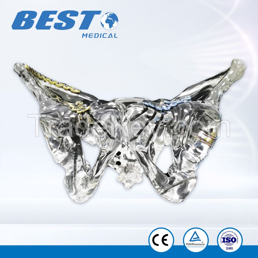 Transparent Clear Resin Femoral &amp;amp;amp; Tibial Bones Model with Locking Plates and Nails