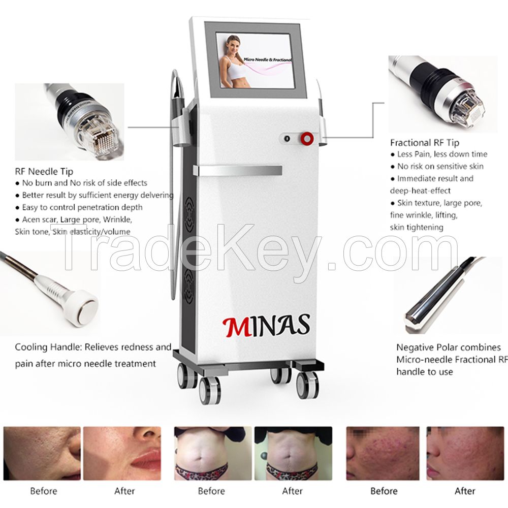 Rf Microneedling Machine Microneedle Rf Skin Tightening Machine Rf Microneedle Fractional