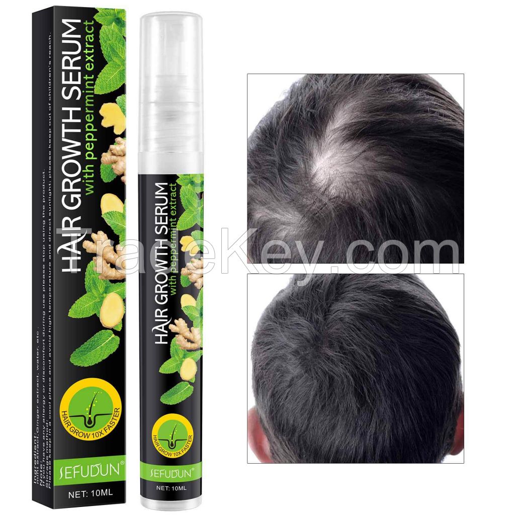 Mint Ginger Vagan Hair Growth Spray to Strengthen,Ordinary Hair Growth Serum for Hair Loss for Women