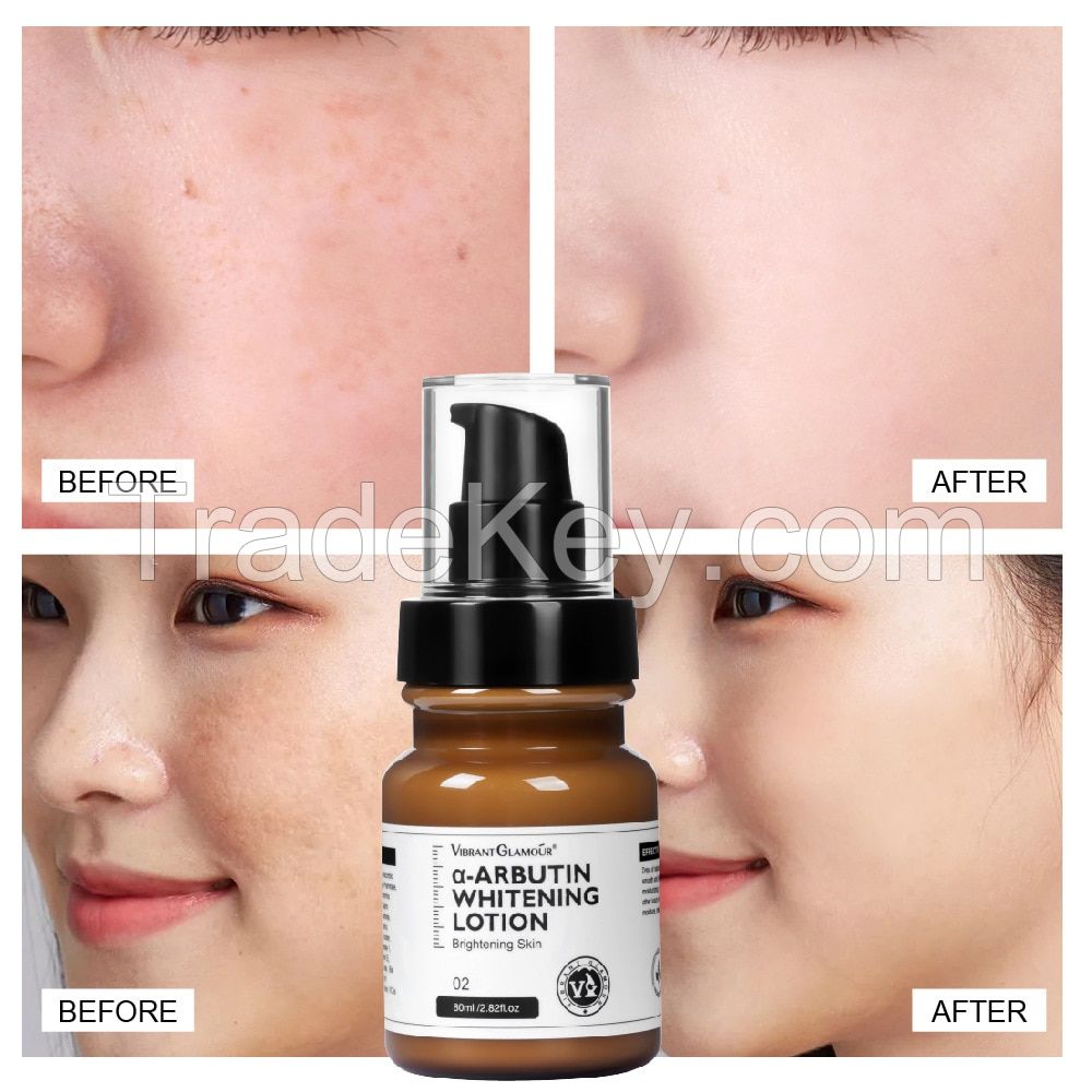 Alpha Arbutin Skin Lightening Whitening Cream for Face To Reduce Pigmentation for Radiant Skin Tone