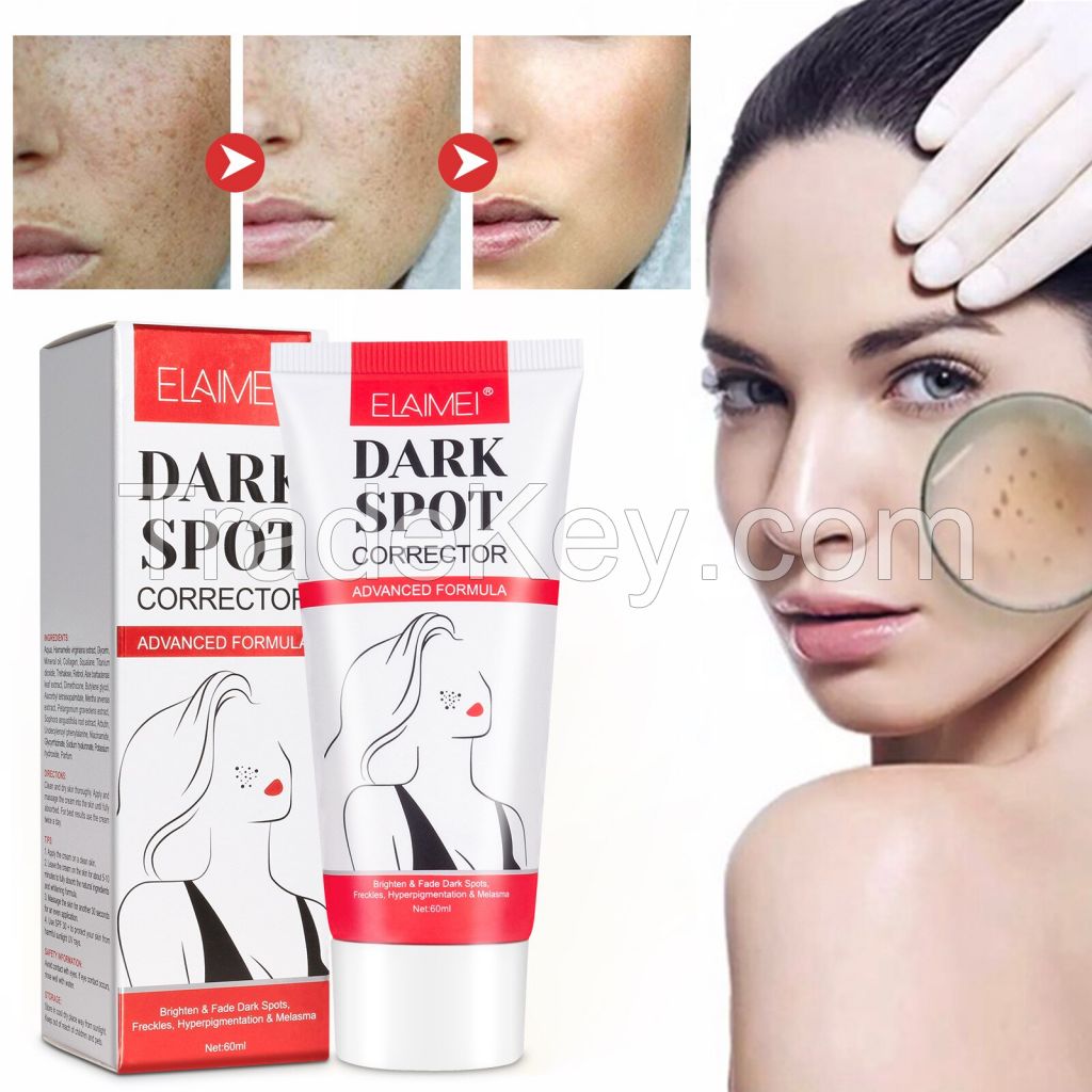 Brightening Dark Spot Remover for Face,Dark Spot Corrector Cream for Body for Women