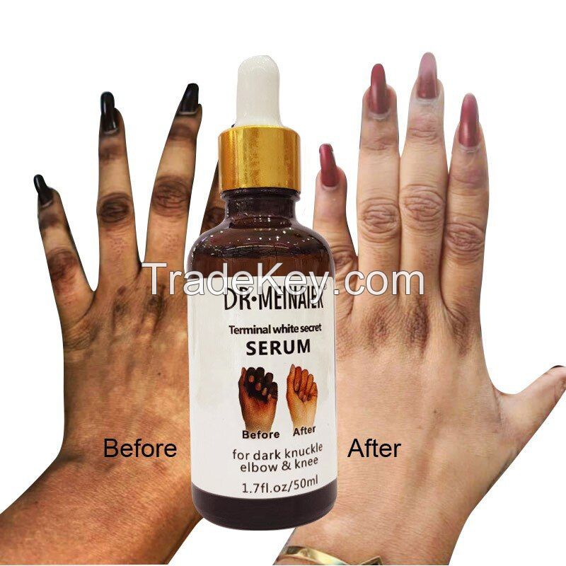 Dark Spot Remover,Skin Lightening Brightening Serum for Dark Knuckle Elbow & Knee