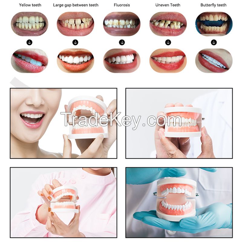 Non-fracture adhesive base denture