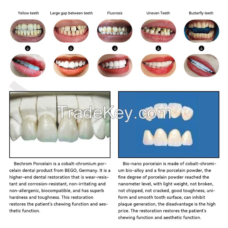 Metal Porcelain Denture - Major Brand