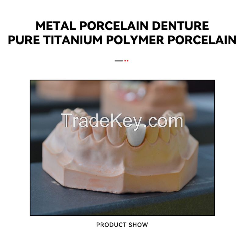 Metal Porcelain Denture - Pure Titanium Polymer Porcelain