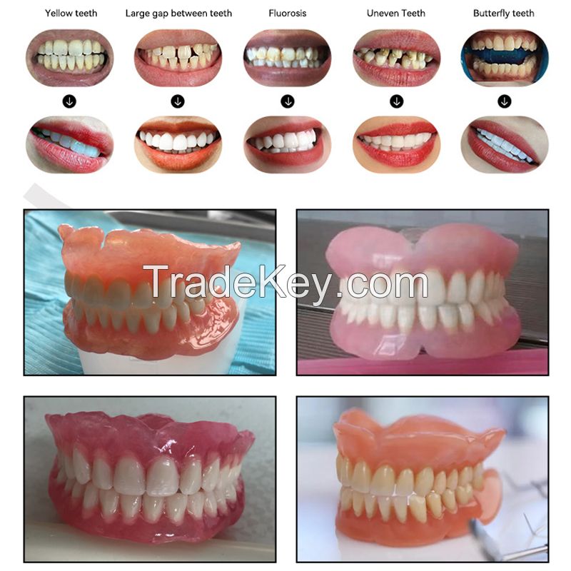 Resin Base Denture