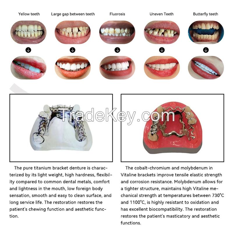 Bracket Base Denture