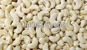 Cashew Nuts &amp;amp;amp;amp;amp; Dry Fruit | Dried Fruits