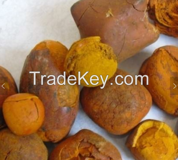 Best Gallstone