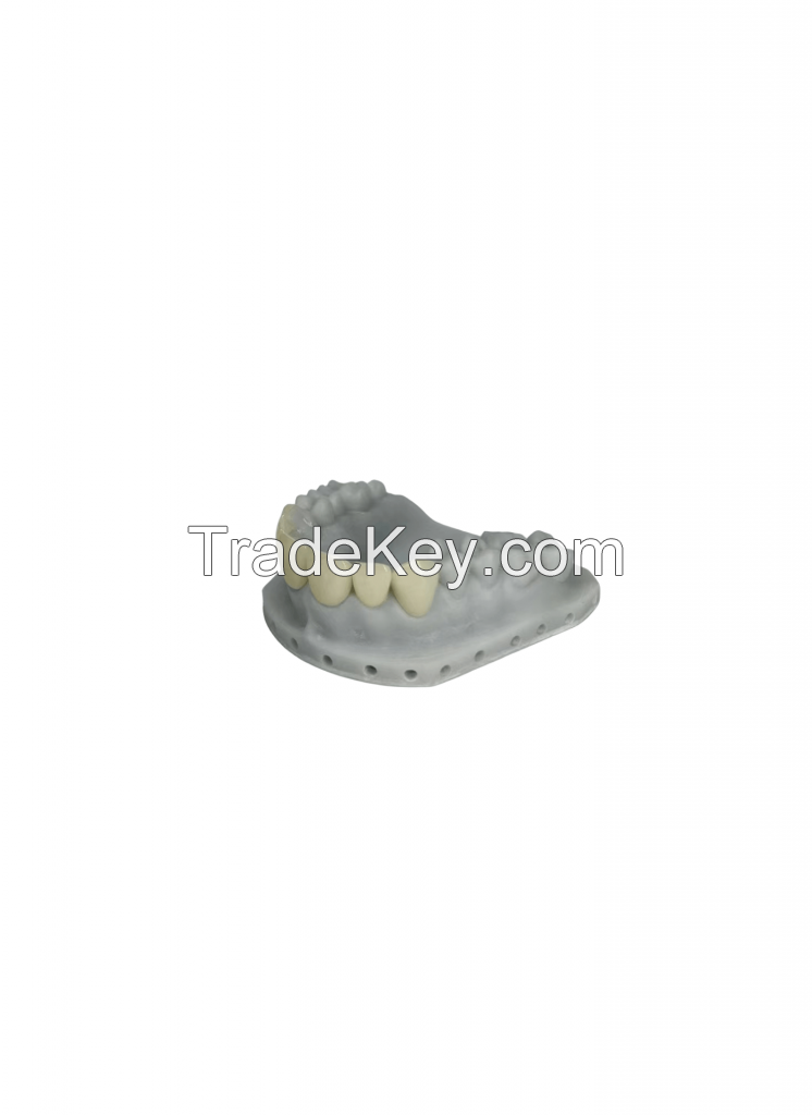 Dental temporary crown resin, high-strength and high toughness tempora