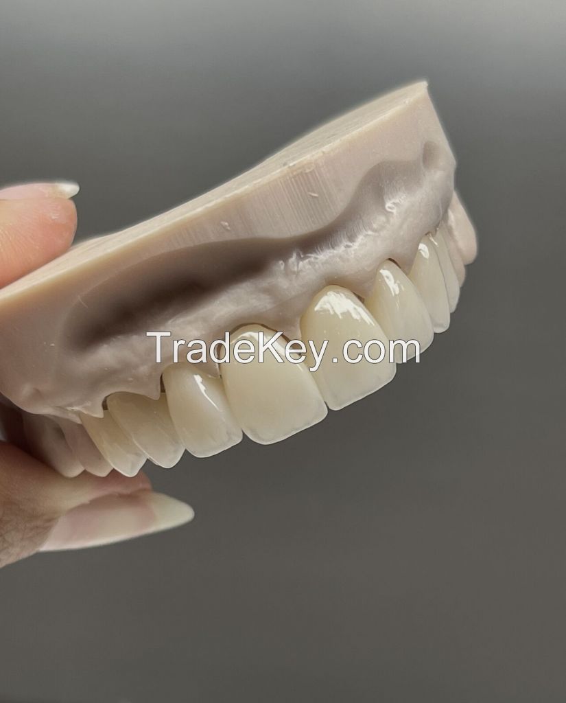 Shenzhen MYY Dental Lab Seeking overseas cooperation - China