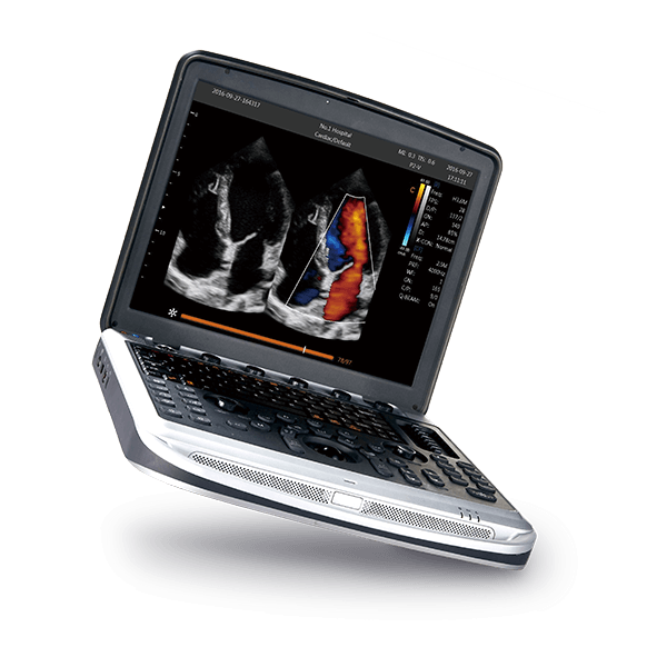 women&#039;s health ultrasound