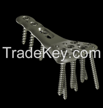 Orthopedic implant ( Locking plate ) { dedania AT gmail DOT com }