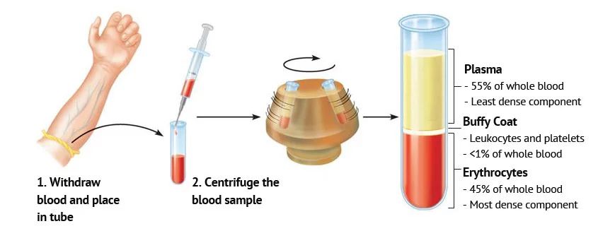 Medical Supplies PRP Collection Tubes 10ml 30ml PRP Tube With Gel