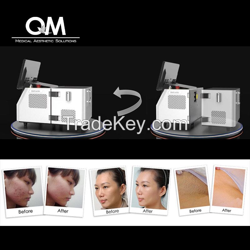 IPL+SHR Hair Removal and Skin Rejuvenation Beauty Equipment