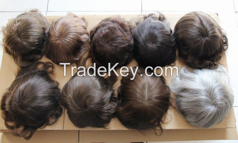 toupee, hair replacement systems