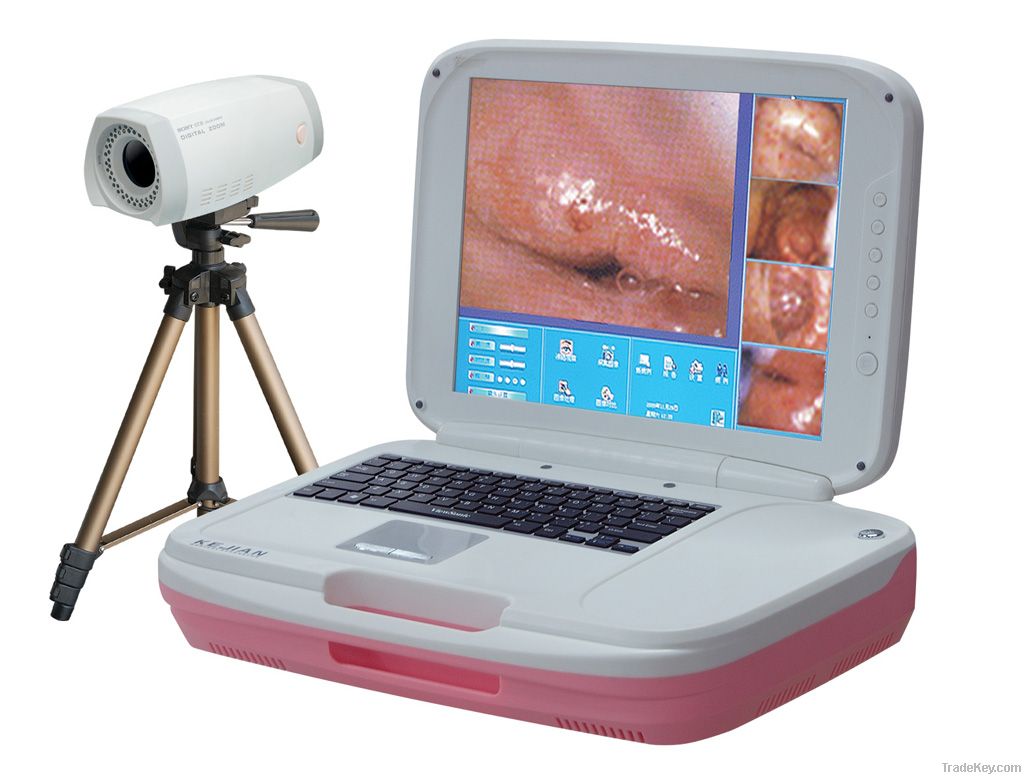 Colposcopy Imaging System