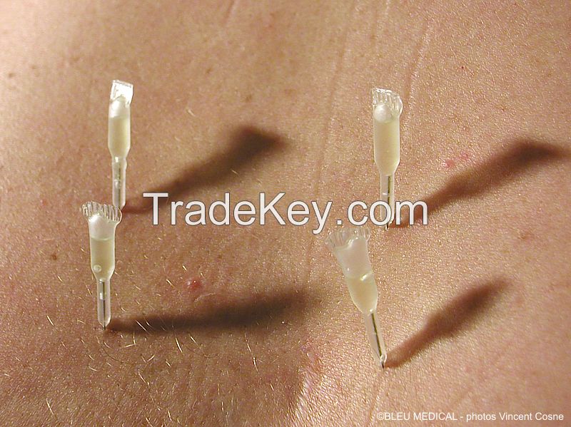 BMN- Dry & needling