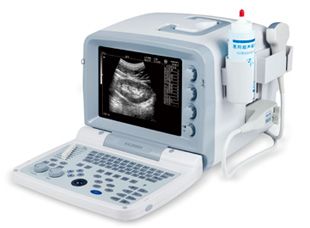 Full Digital B Mode Ultrasound Scanner (KX2000G, 11Edition)