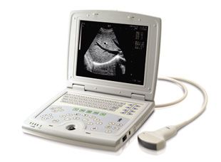 Full Digital B Mode Ultrasound Scanner (KX5000)