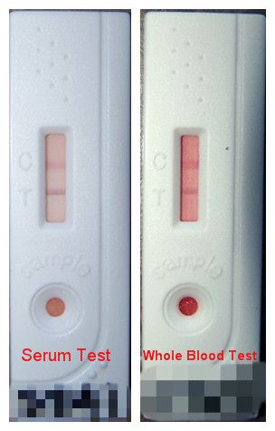 Foot and Mouth Disease NSP Ab Test