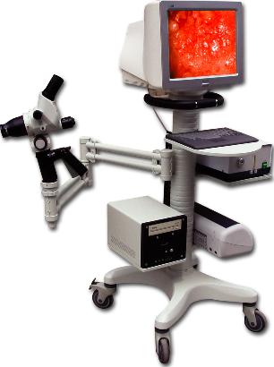 2M-pixel Electronic Colposcope(YD-G)