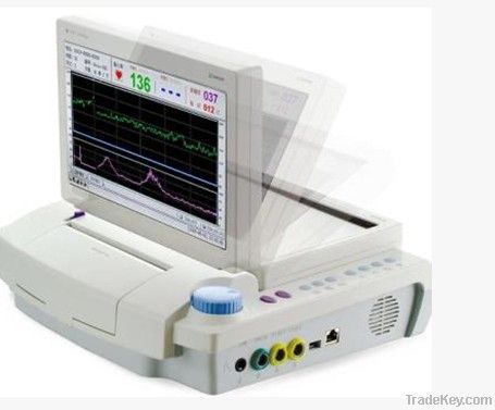 Three parameters of fetal monitor