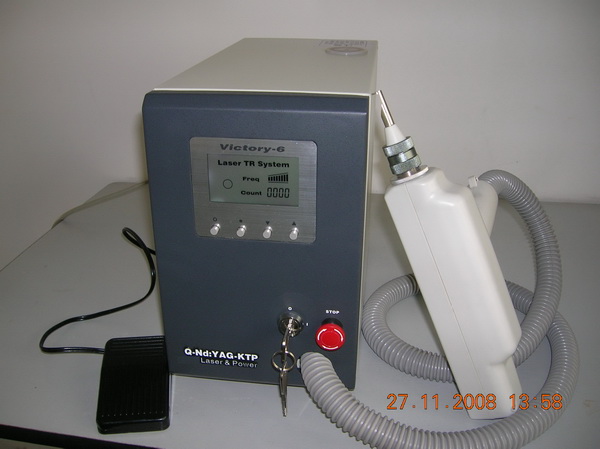 yag laser for tatoo removal
