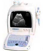 ultrasound diagnostic-emp860