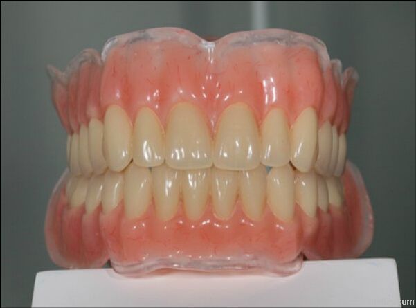 Removable denture