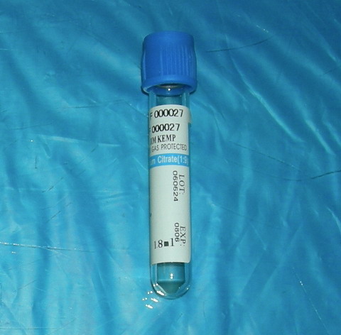 Sodium Citrate Tube 1:9