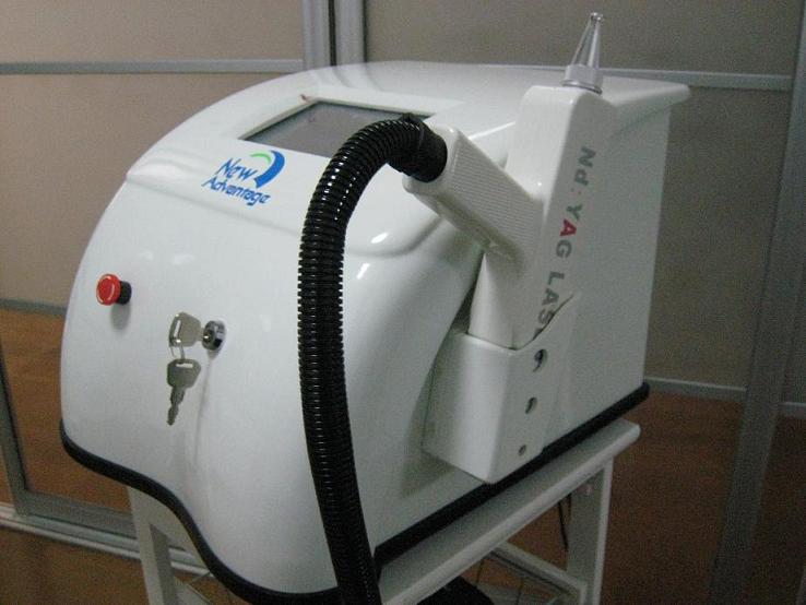 YAG laser tatoo removal