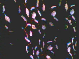 Tunics