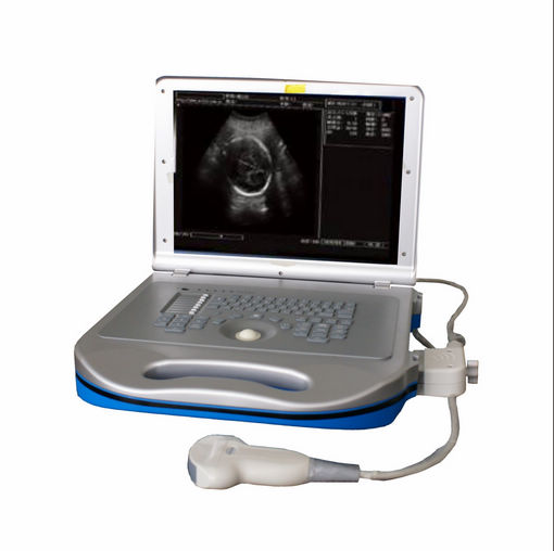 Ultrasound Scanner (BEU-8360A)