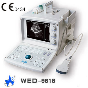 Ultrasonic Diagonstic