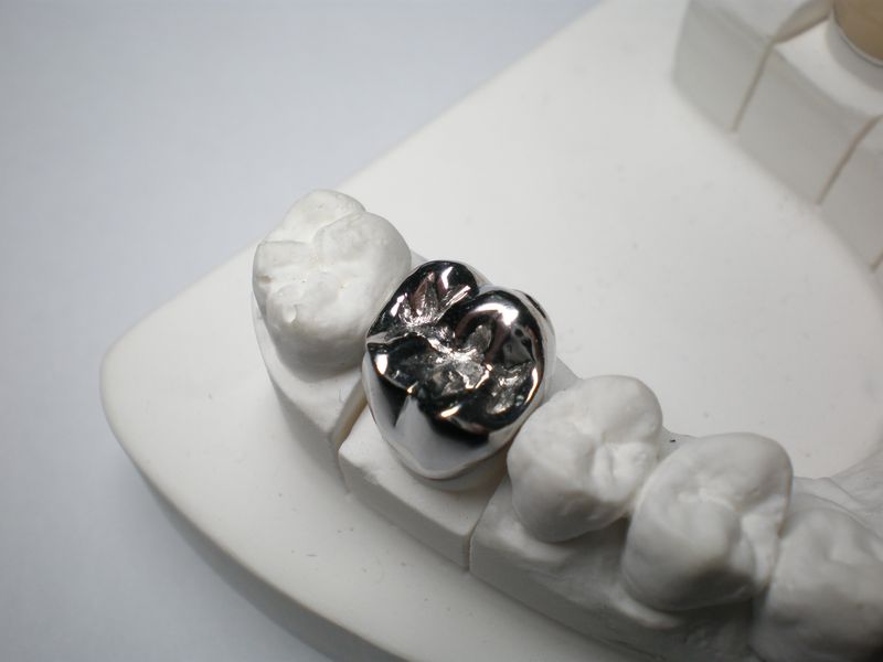 Dental full metal crown