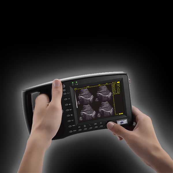 Ultrasound scanner 3100V