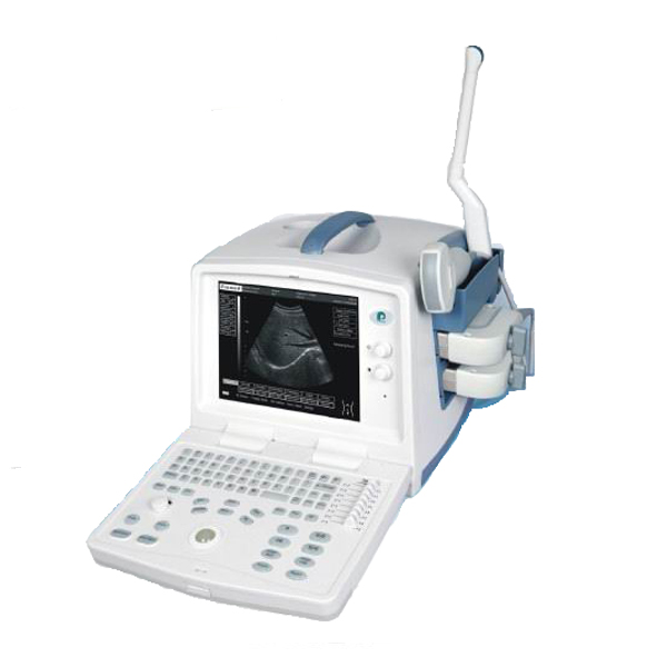 3D ultrasound