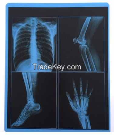 medical x-ray film