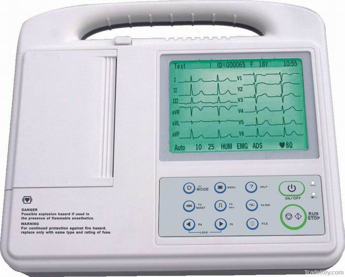 single channel ECG(EKG)