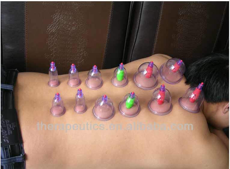 Chinese Traditional Vacuum Cupping Therapy set 24 pcs