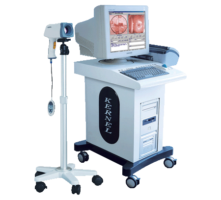 Colposcope Digital Imaging System