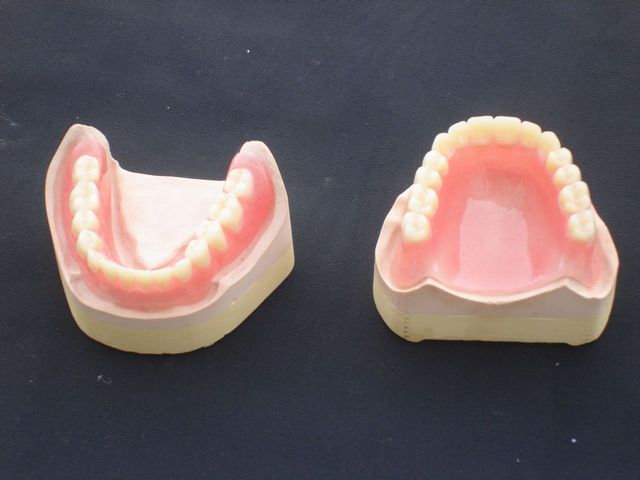 Flexible acrylic full/partial denture