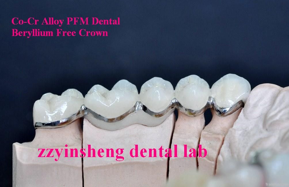 Ni-Cr Alloy Beryllium Free PFM Dental Crown Product Supplier